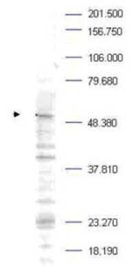 Western Blot: PLK1 [p Thr210] Antibody [NBP1-78021]